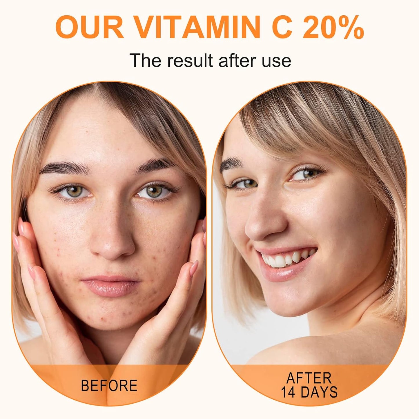 Vitamin C Serum for Face - 20% Concentration with Hyaluronic Acid & Retinol | Anti-Aging, Hydrating, 60ml