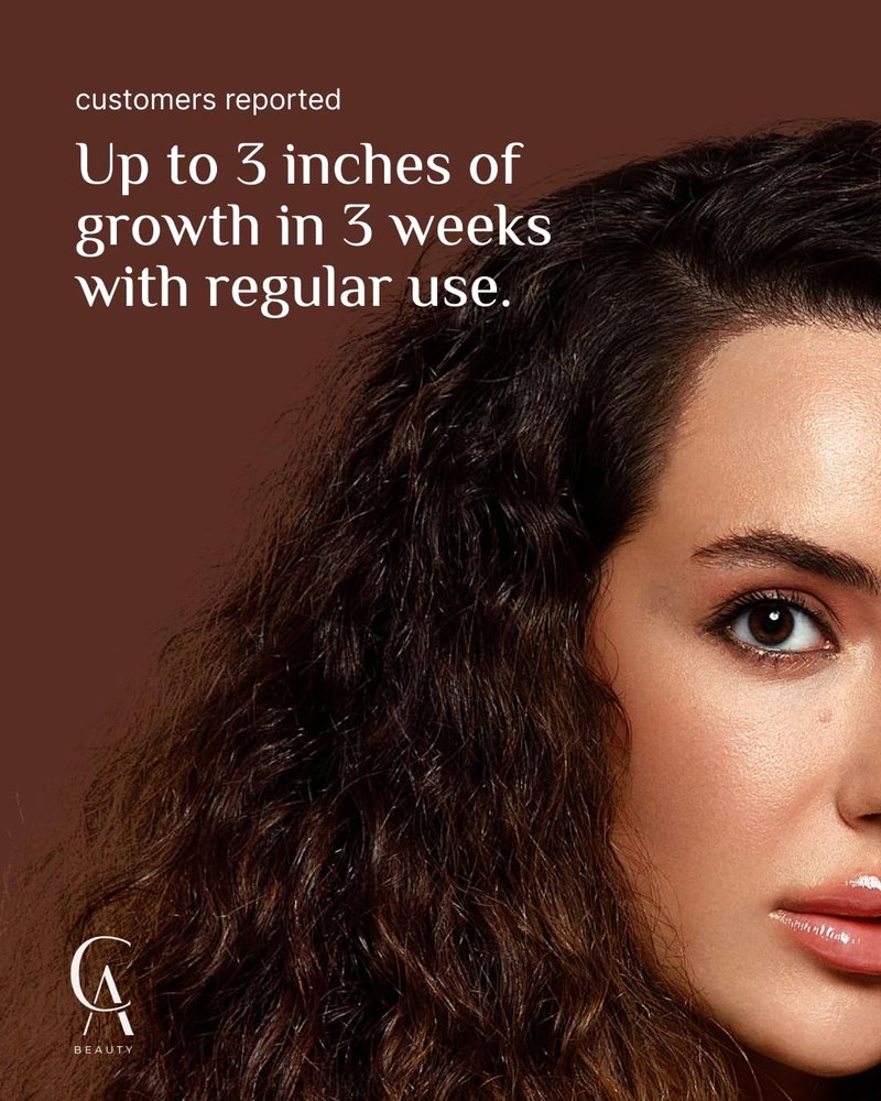 Hair Growth Oil with Rosemary & Peppermint - All-Natural Formula for Thicker Hair | 2oz