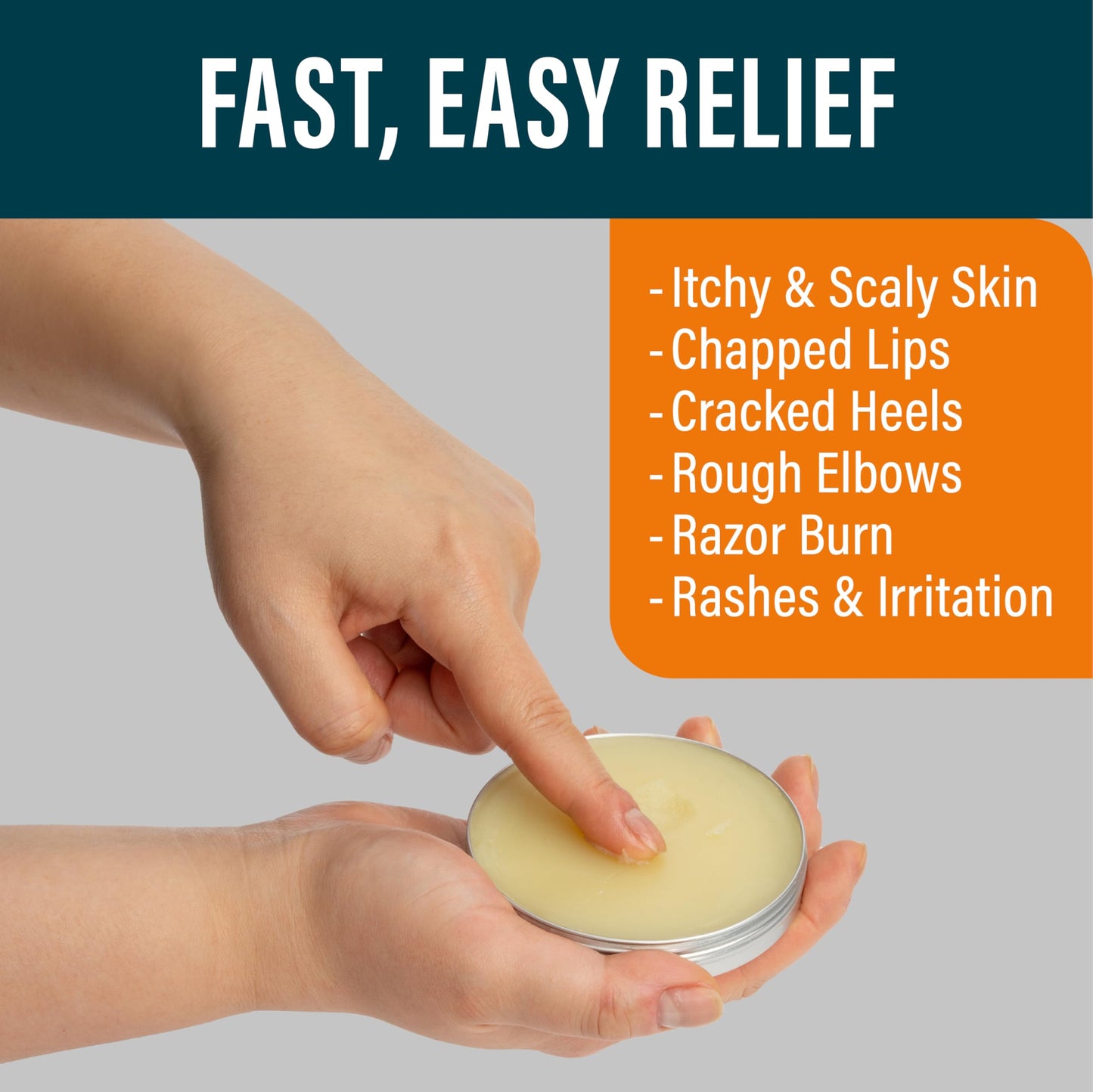 NUVADERMIS Tea Tree Oil Foot Balm – Effective Recovery Balm for Dry, Cracked Feet, Athlete’s Foot, Ringworm & Itchy Skin – Soothing Moisturizer – 2 oz