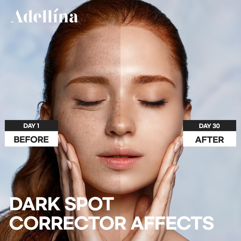 Dark Spot Remover for Face | Vitamin C & Niacinamide Dark Spot Corrector - 1 Fl Oz for Even Skin Tone