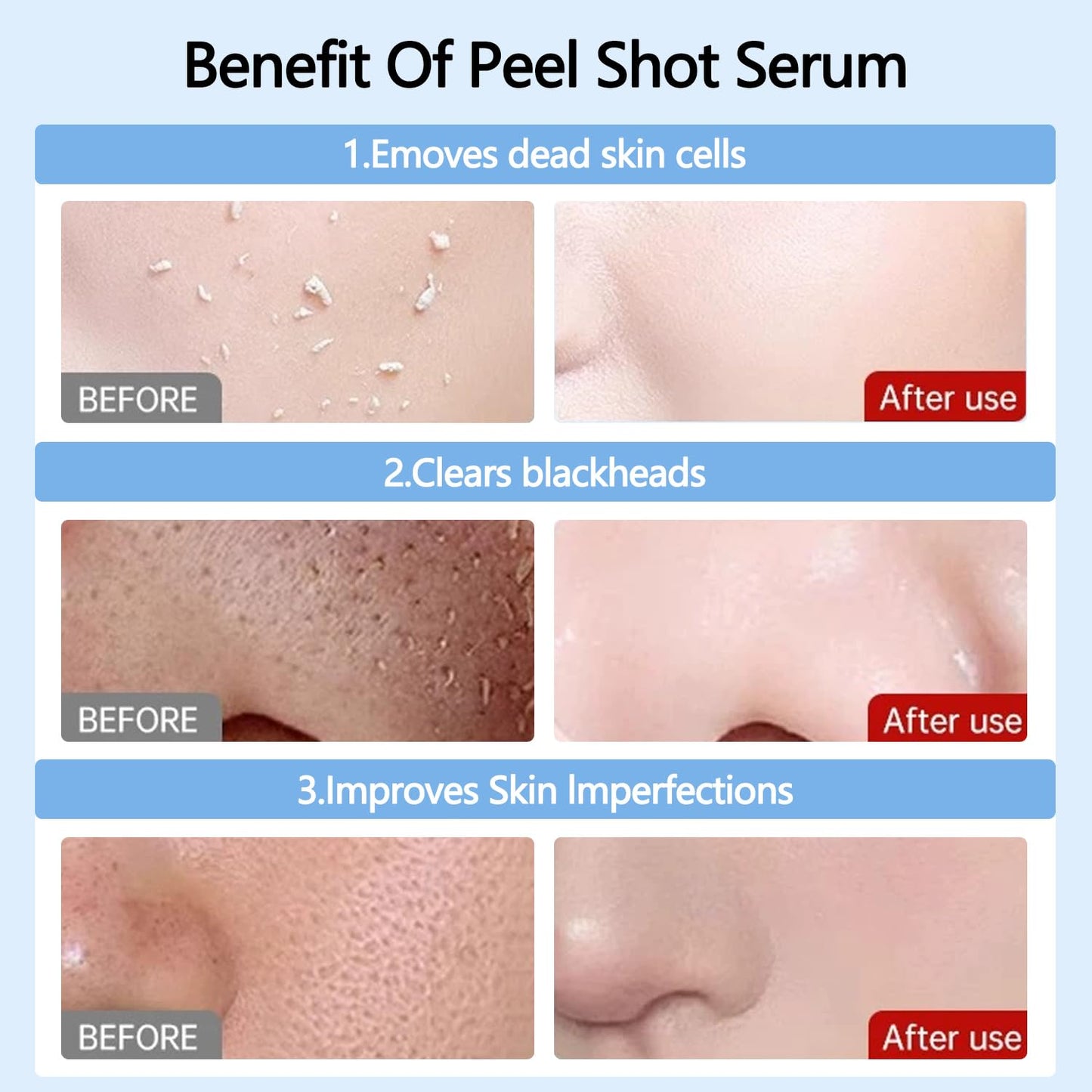 2 Pcs Peel Shot Glow Rice Ampoule Duo – White & Black Rice Exfoliant for All Skin Types Gentle Peel & Deep Hydration Dead Skin Cells Remover
