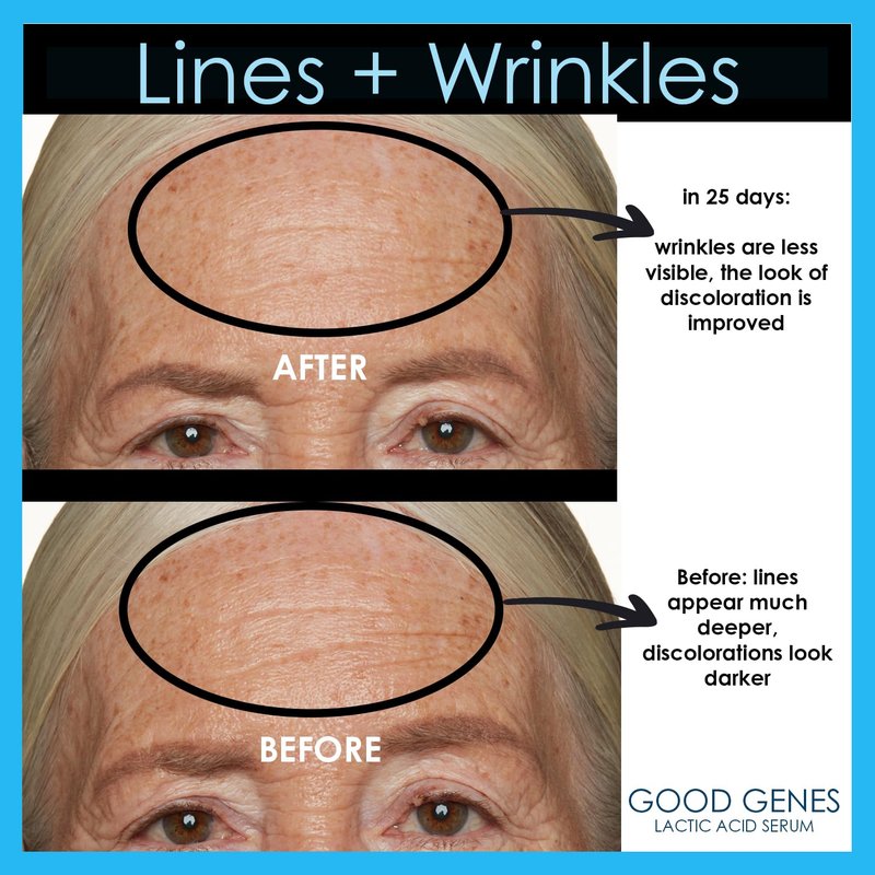 Sunday Riley Good Genes All-in-One Lactic Acid Treatment Face Serum