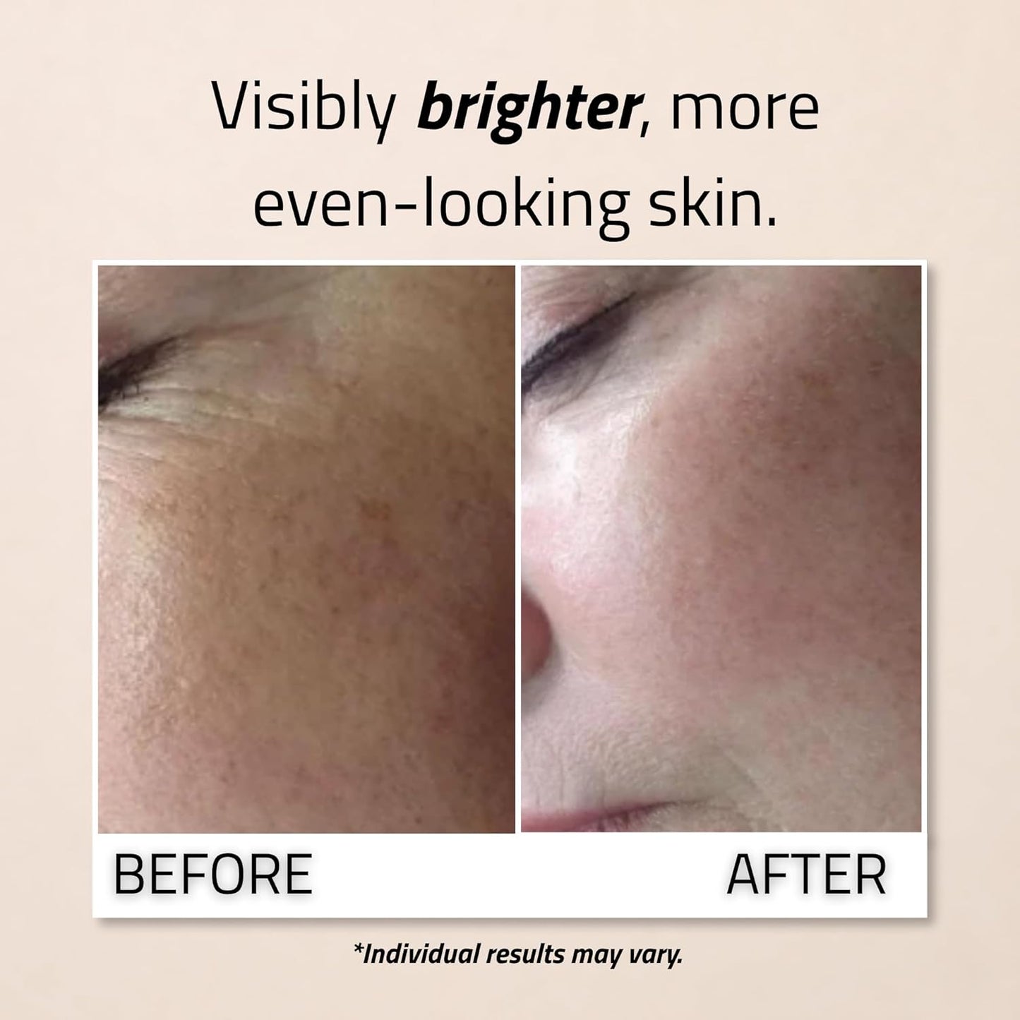 Vitamin C Serum for Face - Brightening with Hyaluronic Acid & Vitamin E | 2 oz