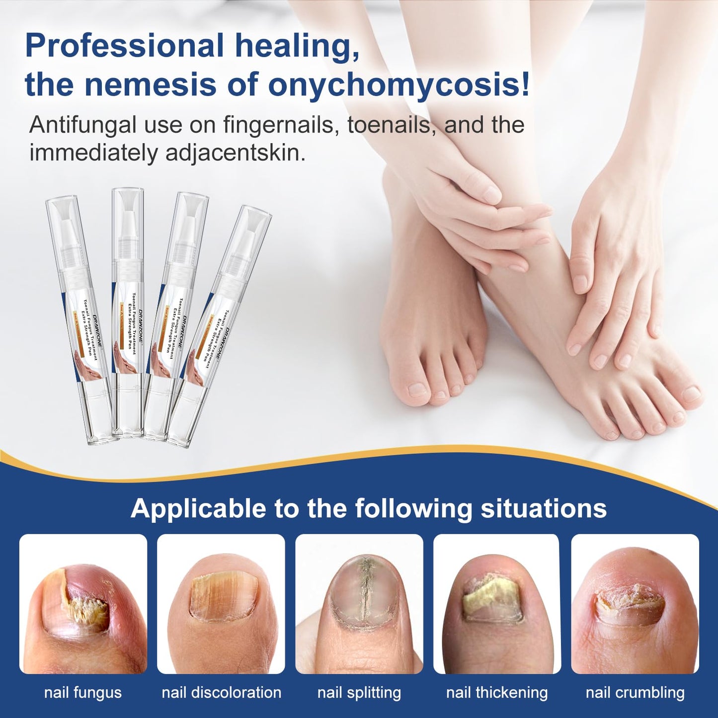 Toenail Fungi Treatment Extra Strength - Fungi Nail Pen, 25% Undecylenic Acid, Ingrown toenail treatment, Fungus nail treatment, yellow toenail, Damaged Nails foot fungus treatment extra strength