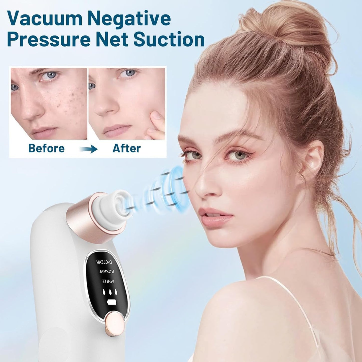 Blackhead Remover Vacuum with Water Chamber, Black Head Remover and Deep Hydration for Face, Pore Vacuum for Men and Women, Blackhead Remover Tools, 6 Suction Heads & 3 Adjustment Modes
