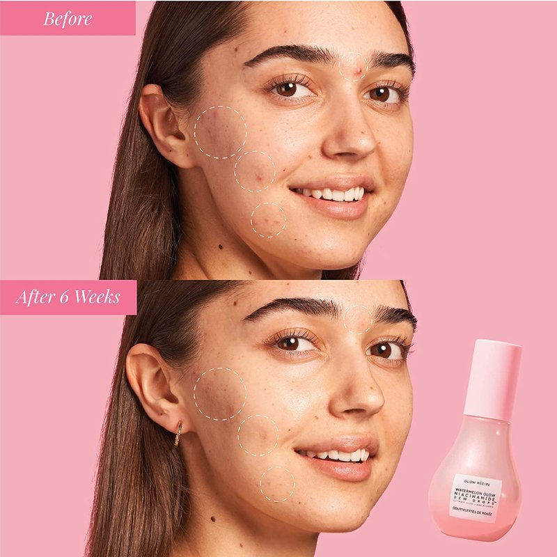 Glow Recipe Watermelon Niacinamide Dew Drops - Hydrating Face Serum & Primer with Hyaluronic Acid | 40ml