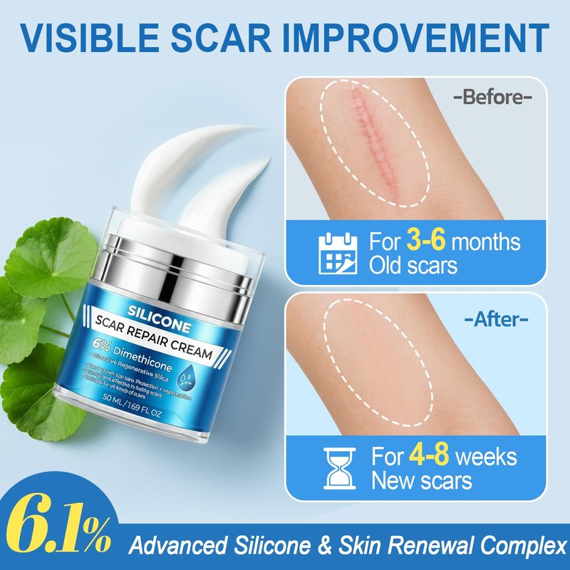 MythosFlow Scar Cream 6% Dimethicone Silicone Cream for Scars, Advanced Scar Removal Cream for Surgical, C-Section, Acne, Keloids, Burns, Old & New Scars, with Scar Tape, 1.69 fl.oz + 1.5m