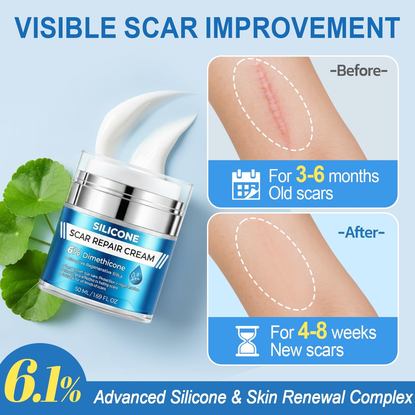 MythosFlow Scar Cream 6% Dimethicone Silicone Cream for Scars, Advanced Scar Removal Cream for Surgical, C-Section, Acne, Keloids, Burns, Old & New Scars, with Scar Tape, 1.69 fl.oz + 1.5m