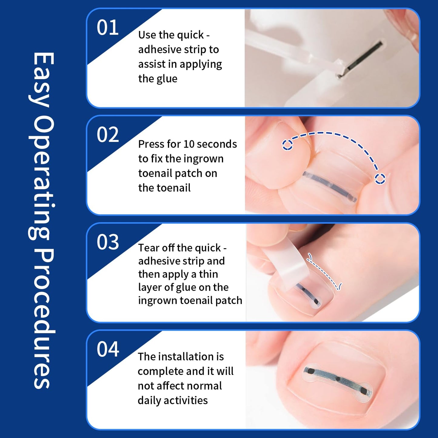 Corrector Kit - 3 Sizes