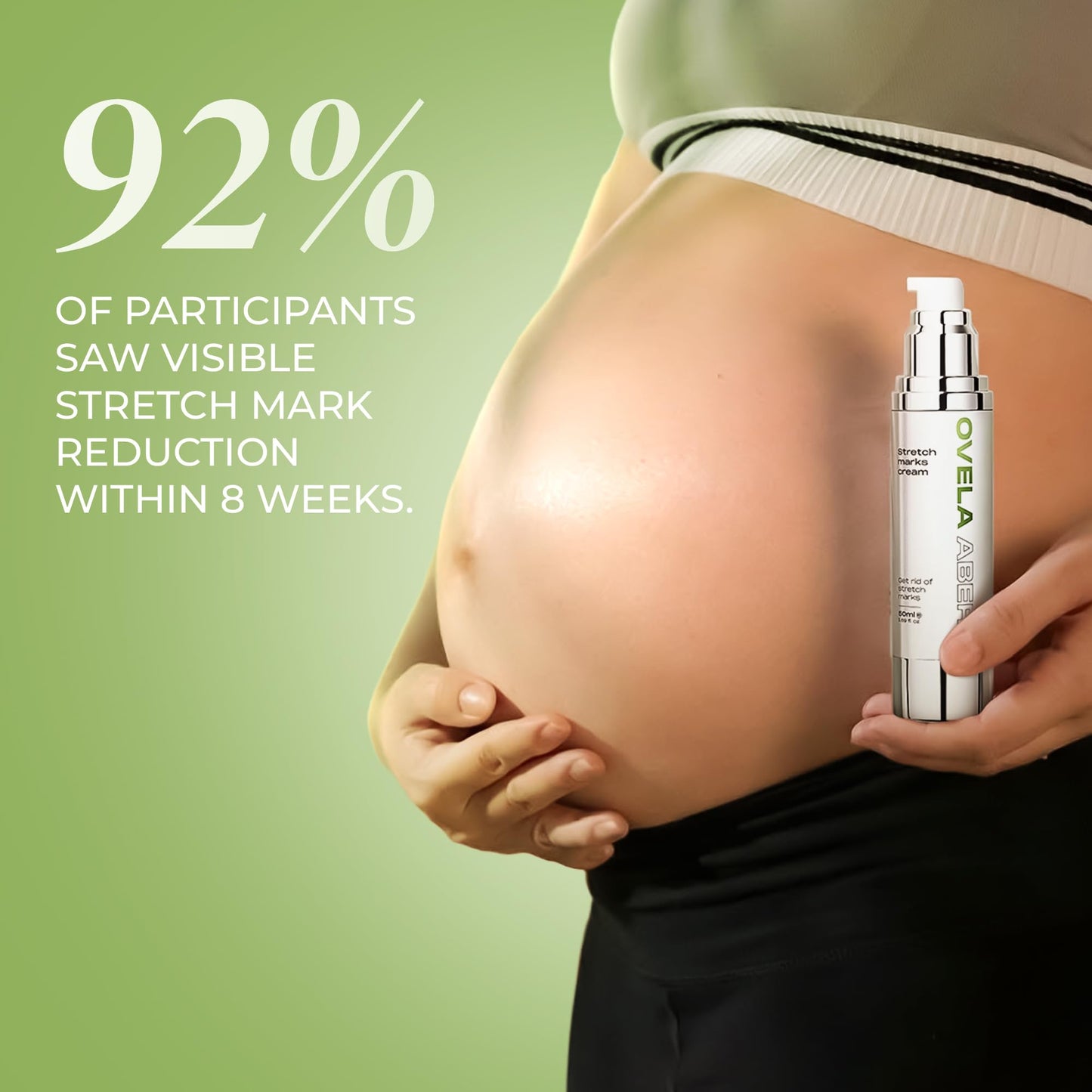 Abera Ovela Maternity Stretch Mark Cream for Pregnancy and Weight Fluctuations, Stretch Mark Treatment Pregnancy Must Haves, Deep Stretch Mark Removal, 1.69 fl oz