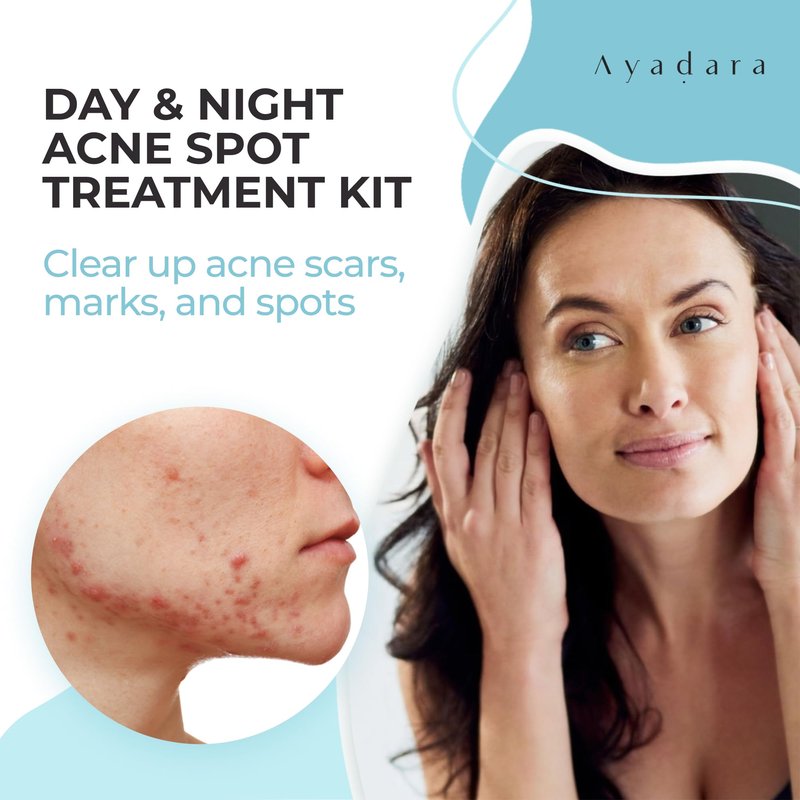 Ayadara Day & Night Cystic Acne Spot Care for Skin, Hormonal Acne Support for Daytime & Overnight, Cystic Acne Skin Balancing Formula for Face, Acne Cream with Tea Tree & Bentonite Clay, 90 Day Supply