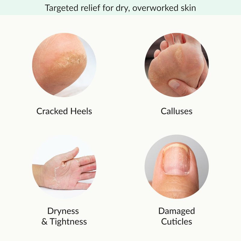 Epielle Relaxing & Nourishing Hand & Foot Masks, Soften Dry, Overworked Skin, Self Care Gifts for Women, Spa Kit, Mothers Day Gifts, 6 Moisturizing Gloves & 6 Moisturizing Socks