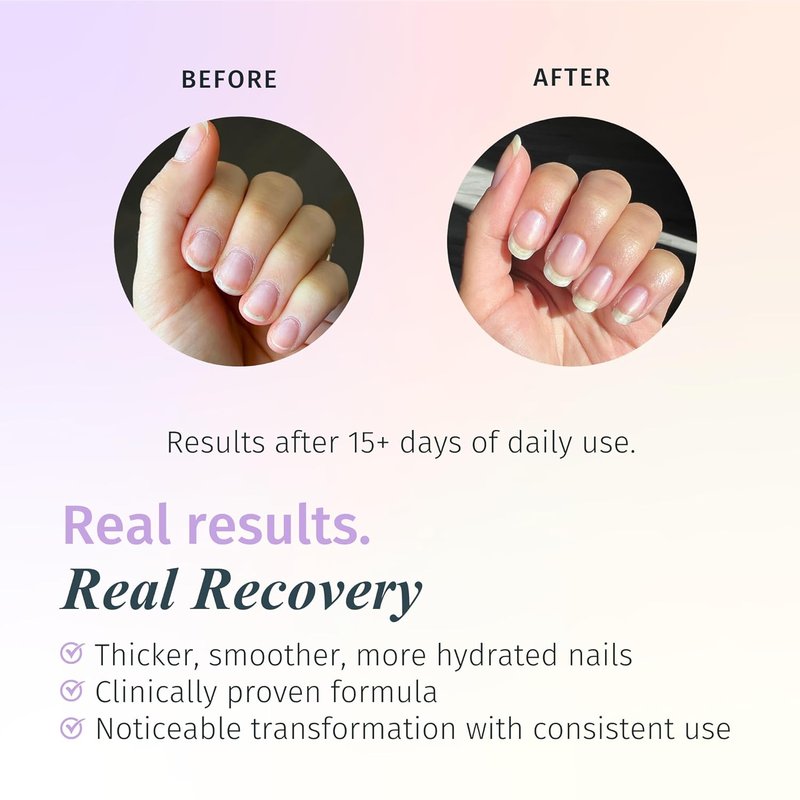 Duri Rejuvacote 2 Nail Growth Base & Top Coat - Strengthening Nail Hardener for Peeling & Fragile Nails | 15ml