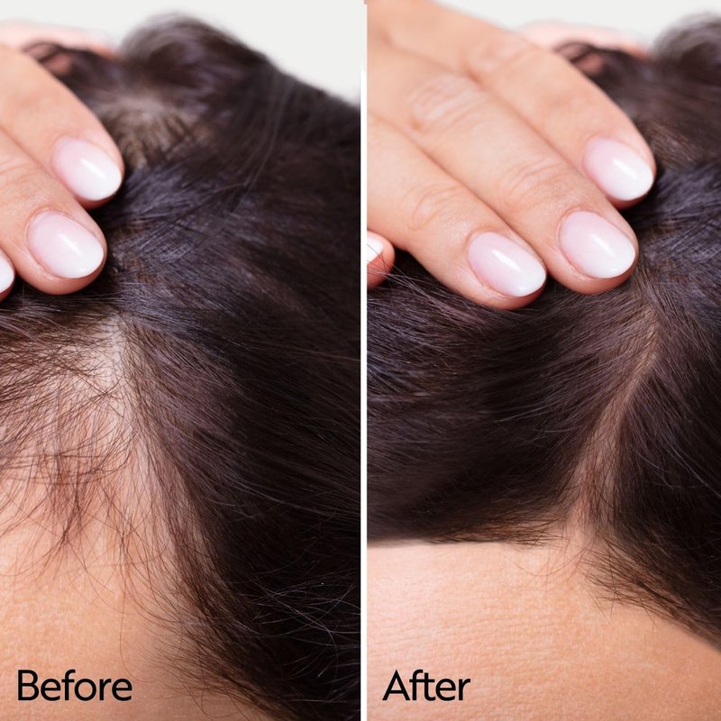 Ahuhu Anti-Age Elixir - Caffeine & Redensyl Scalp Treatment for Thicker Hair | 100ml, Vegan