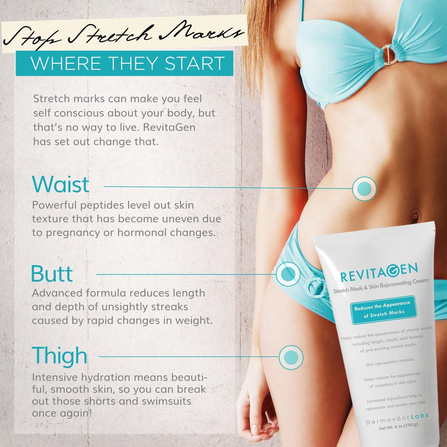 Best Stretch Mark Removal Cream - RevitaGen - Fade & Reduce Stretch Marks Caused by Weight Gain Pregnancy & Muscle Growth - Stop New Stretch Marks From Forming - Natural Moisturizing Treatment with Peptides & Botanicals - Stretch Mark Reducer (6 oz)