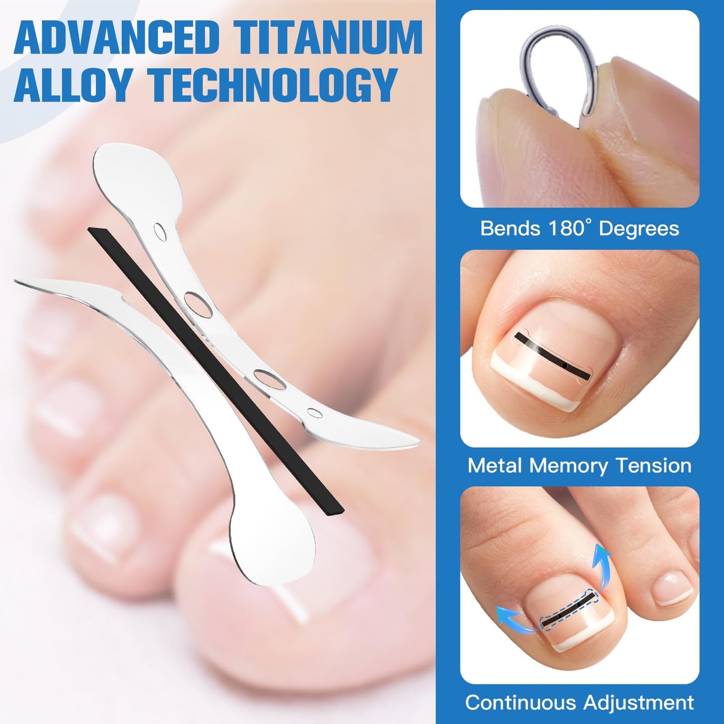 Titanium Alloy Ingrown Toenail Treatment, Ingrown Toenail Removal Kit for Curved Nail Repair, Ingrown Nail Tool for Home Use