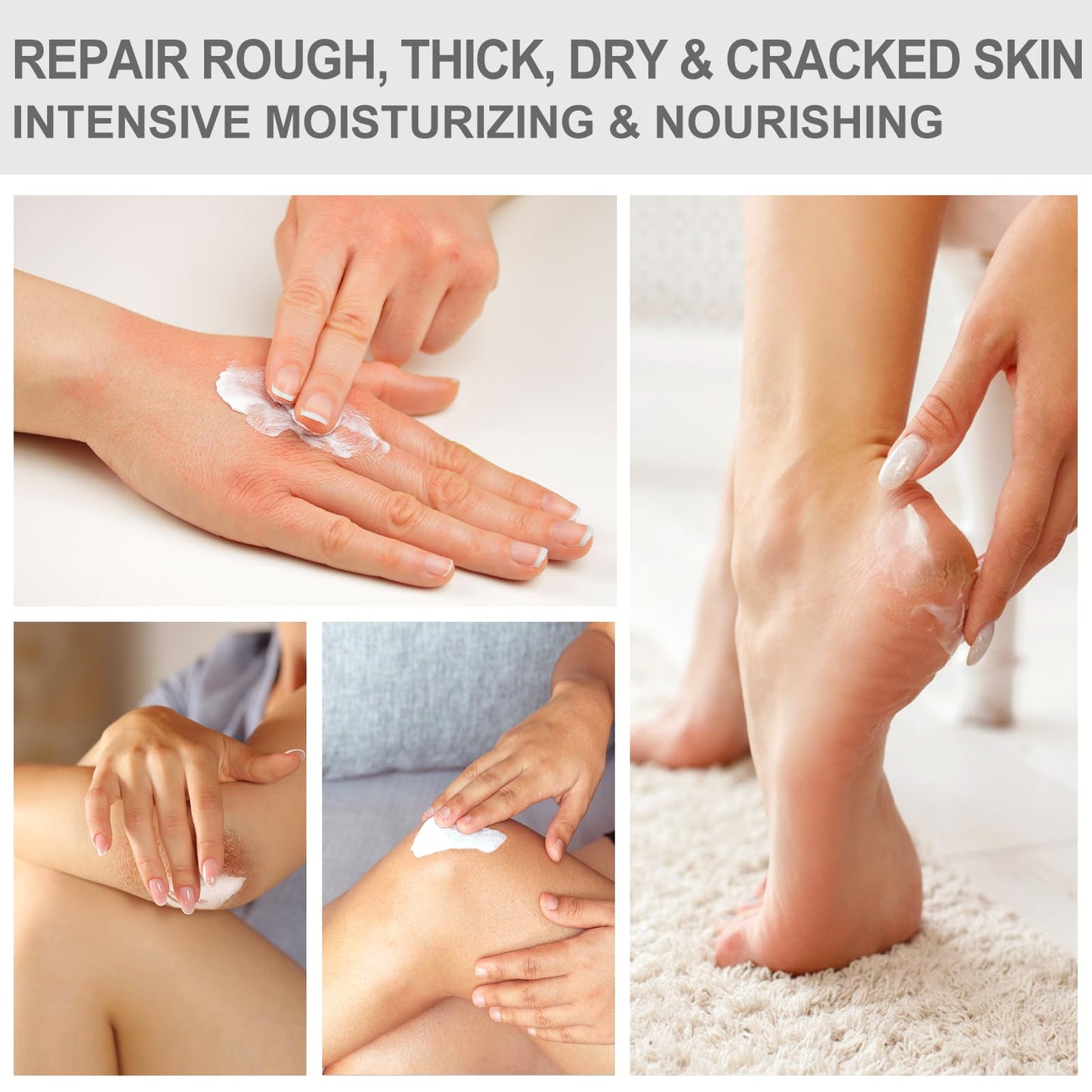 Mouriven 3 Packs Urea Cream 40 Percent - Foot & Hand Cream, for Dry, Cracked Heels, Feet, Knees, Elbows, and Hands, Callus Remover, Maximum Strength Urea Lotion for Softening and Moisturizing