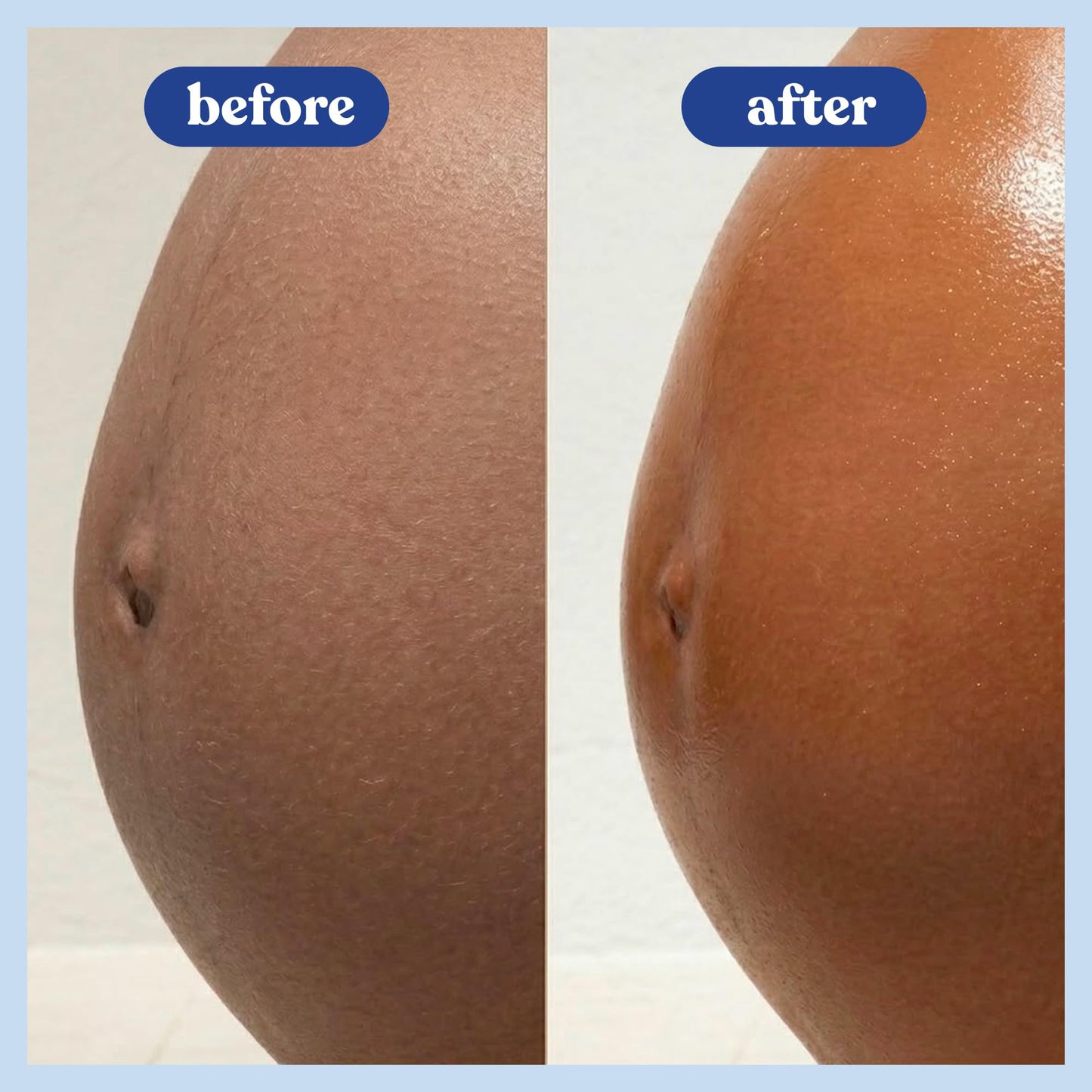 Bumpology Bump Butter, Hydrating Balm for Pregnancy, Stretch Marks, 4 oz