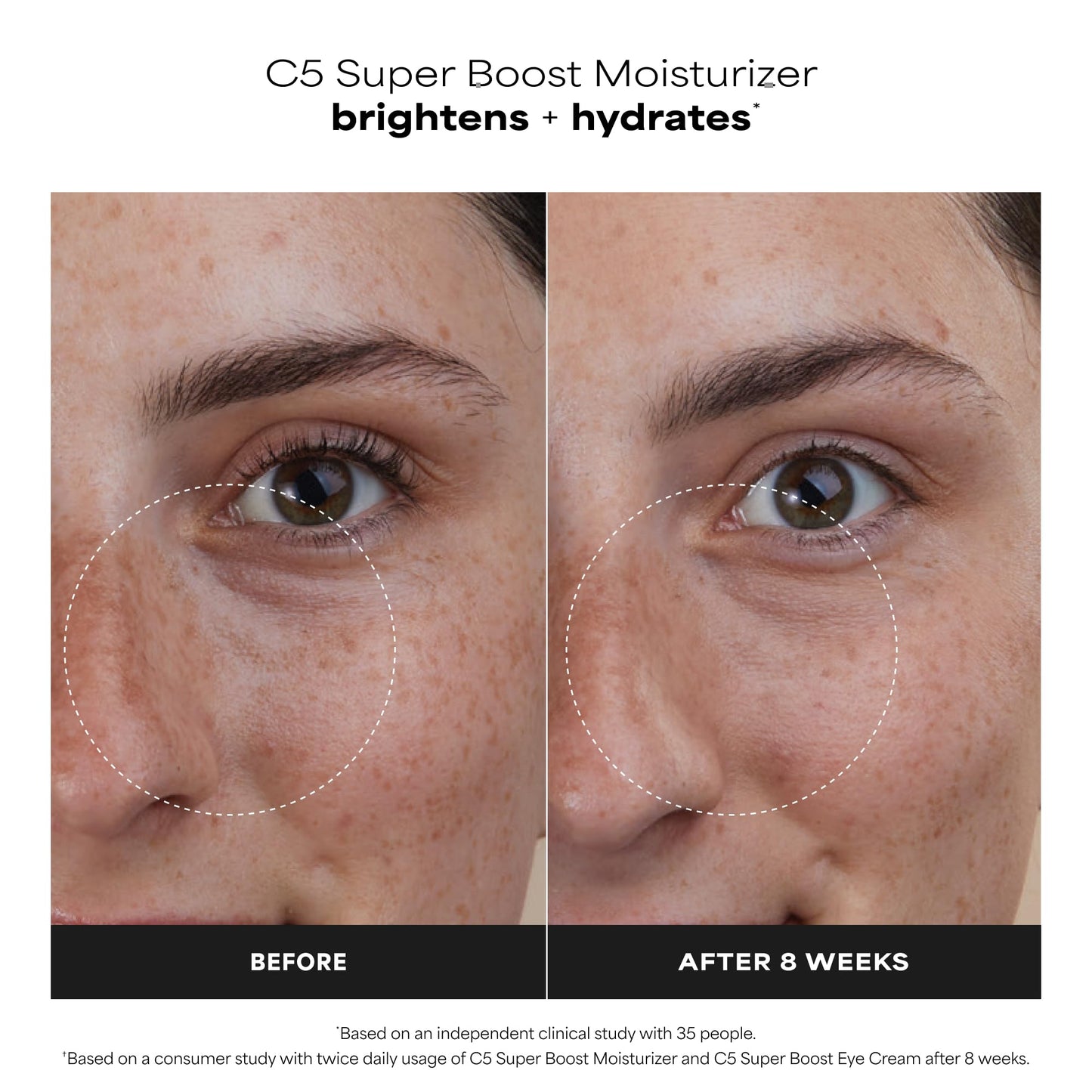 Paula's Choice C5 Super Boost Face Moisturizer with 5% Vitamin C & Squalane, Daily Face Lotion for Discoloration, Uneven Tone, Fine Lines & Breakout-Prone Skin, Fragrance-Free, 1.7 Fl Oz