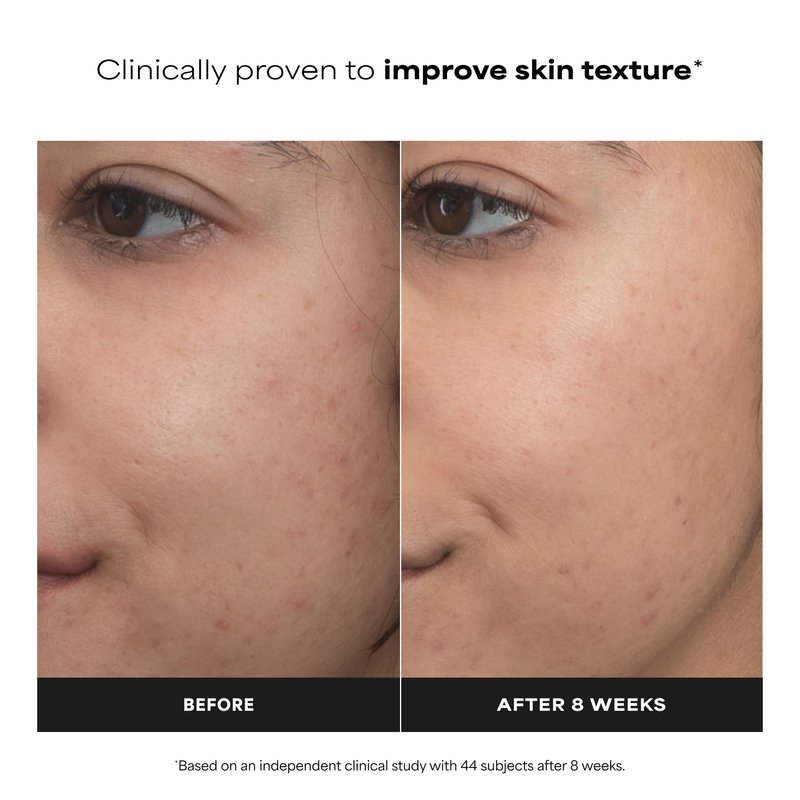 Paula’s Choice Pro Retinaldehyde Dual-Retinoid Advanced Treatment, High Potency Anti-Aging Serum for Breakout-Prone Skin, Radiance & Rough, Bumpy Texture, Fragrance-Free, 0.17 Fl. Oz.
