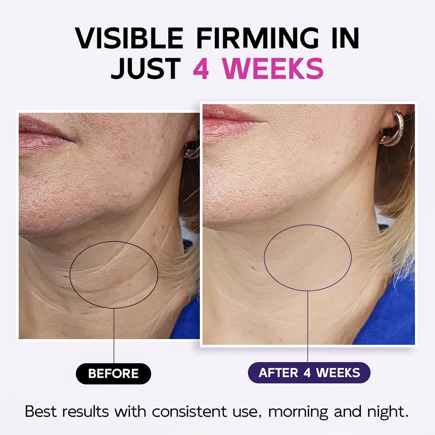 Firming Neck Cream with Retinol