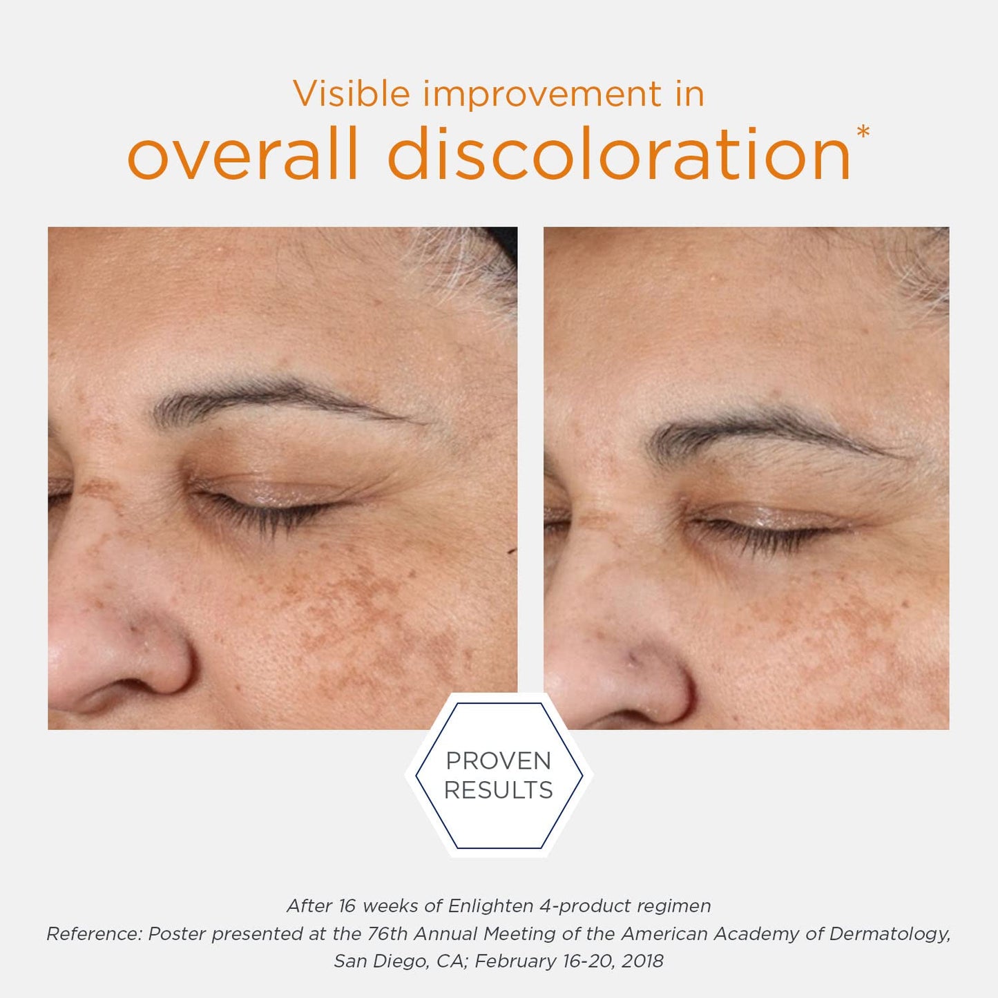 NEOSTRATA Pigment Controller - Brightening Face Treatment with Retinol & Vitamin C | Oil-Free, 1.7 fl oz