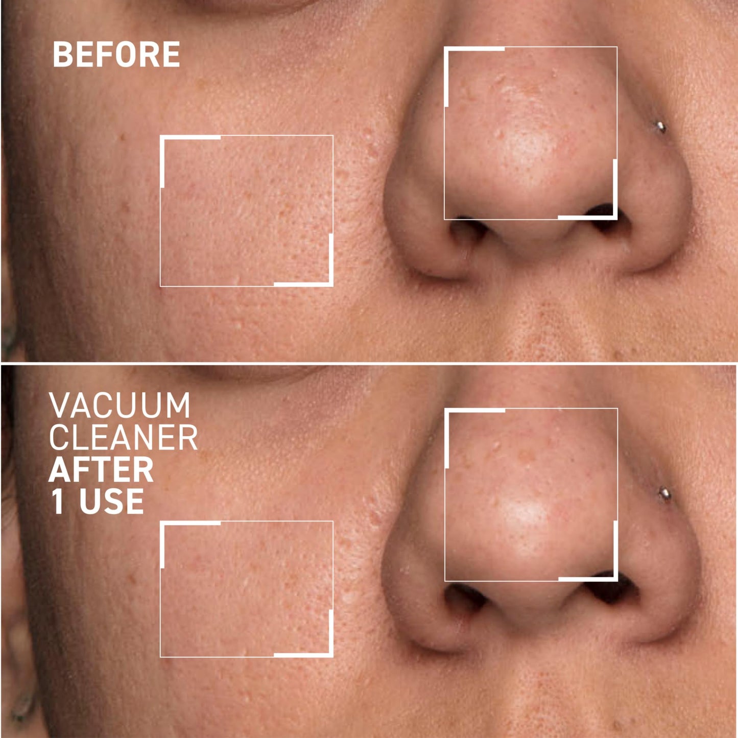 Dr. Brandt Pores No More Vacuum Cleaner - Pore-Purifying Mask to Unclog & Shrink Pores - 1 oz