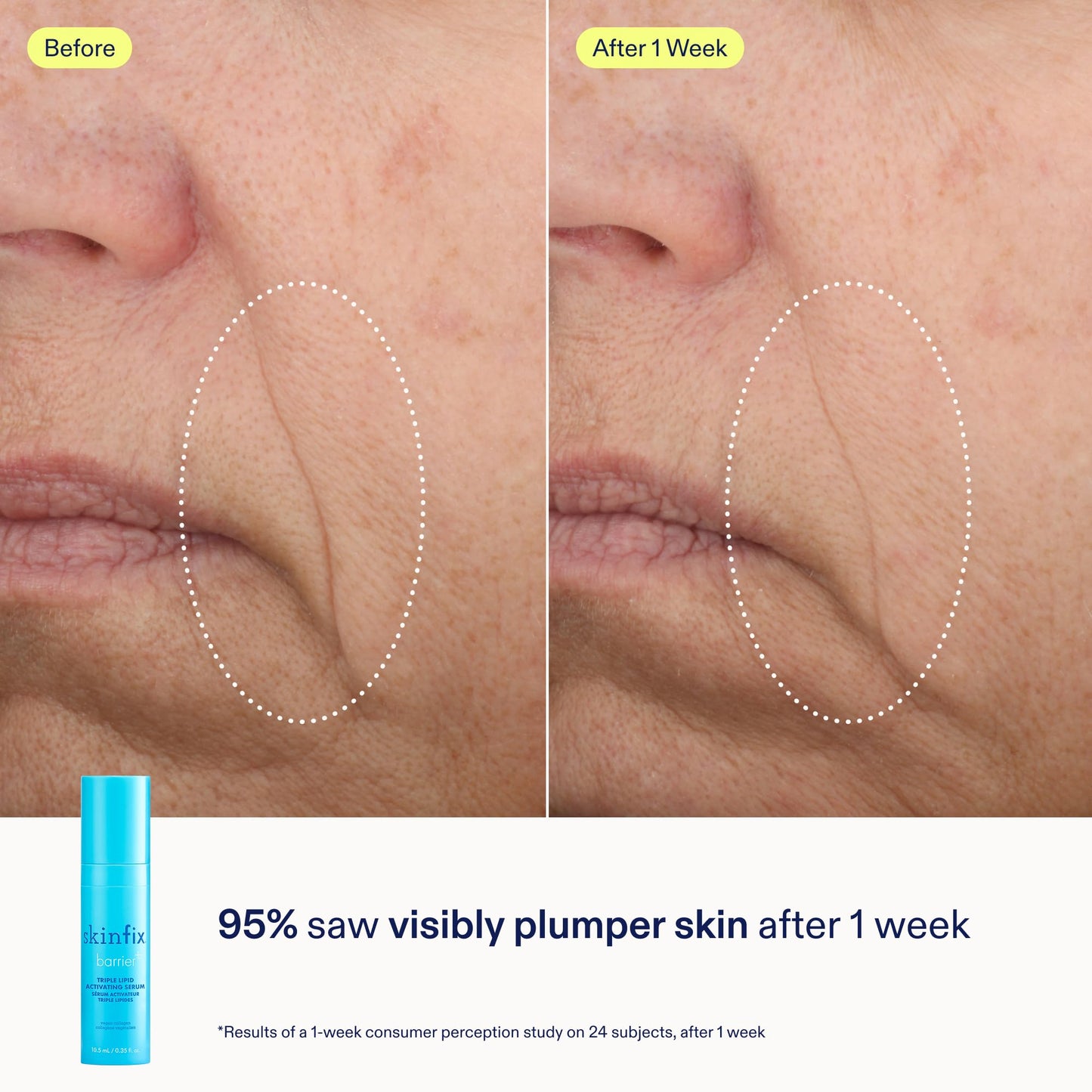 Skinfix Barrier+ Better Skin Starts Here Kit - Includes Mini Triple Lipid-Peptide Cream (0.5 oz), Mini Foaming Oil Cleanser (2 oz) & Mini Triple Lipid Activating Serum (0.35 oz) - Vegan, Cruelty Free