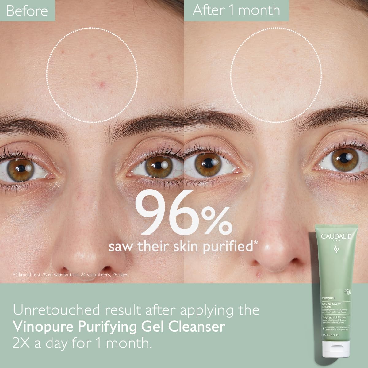 Vinopure Salicylic Acid Cleanser - Pore Purifying Gel for Clear Skin | 150 mL