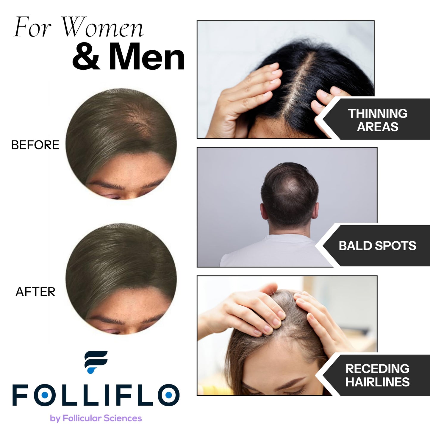 Folliflo Hair Fibers for Thinning Hair Concealment – Instant Fiber Spray & Filler Powder for Fuller-Looking Hair (Black)