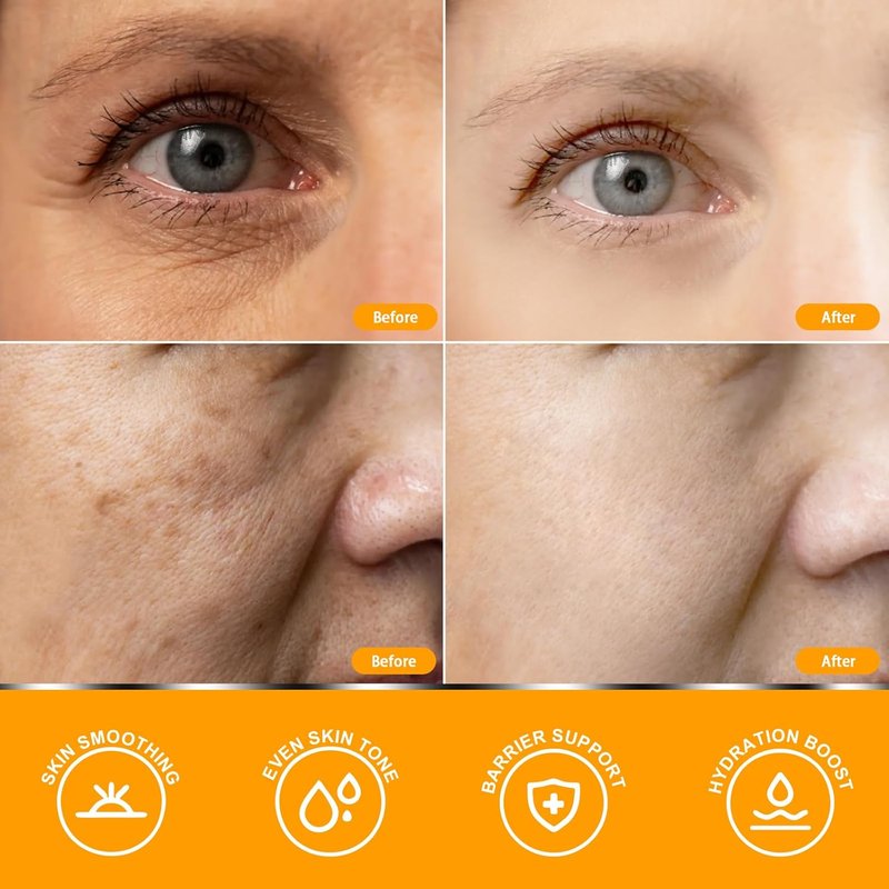 Vitamin C Serum for Mature Skin - Hydrates, Firms & Lifts | Anti-Aging Formula 1.69 fl oz