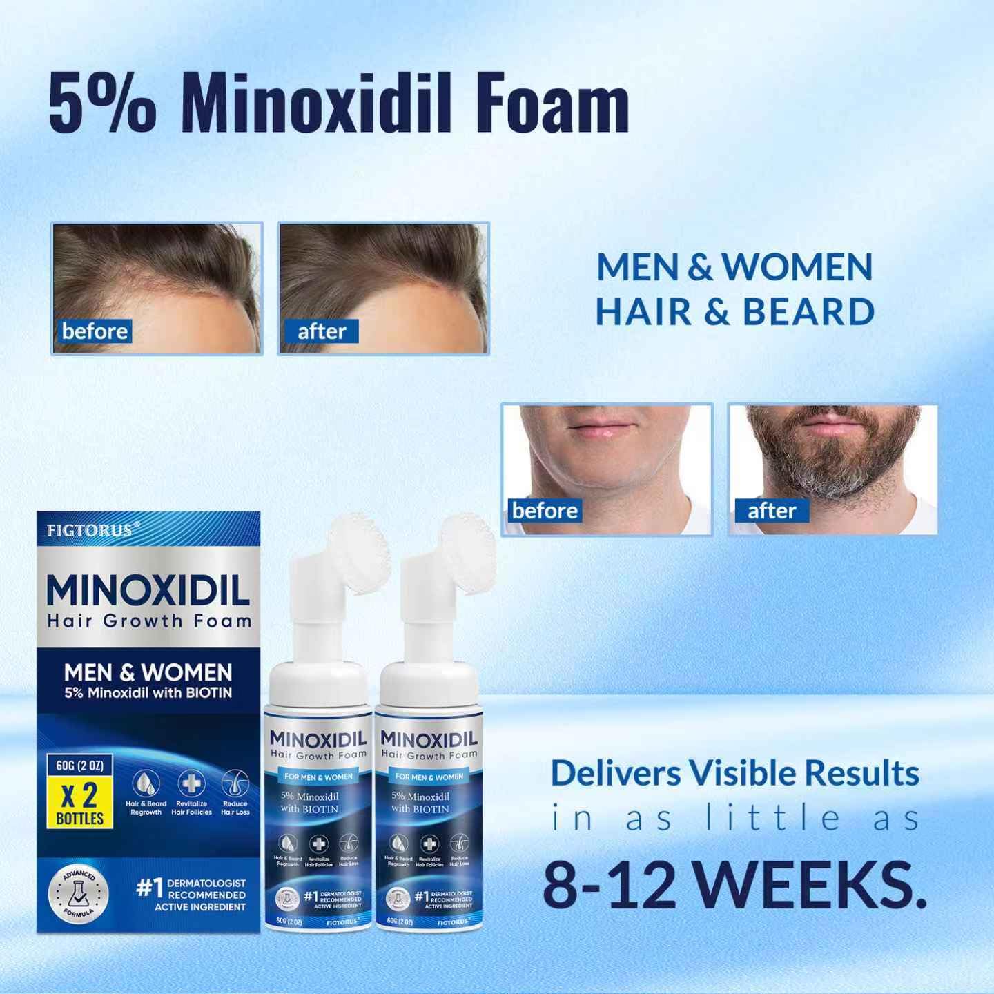 Minoxidil Foam for Hair Growth - 5% Strength for Men & Women | 4 Ounce