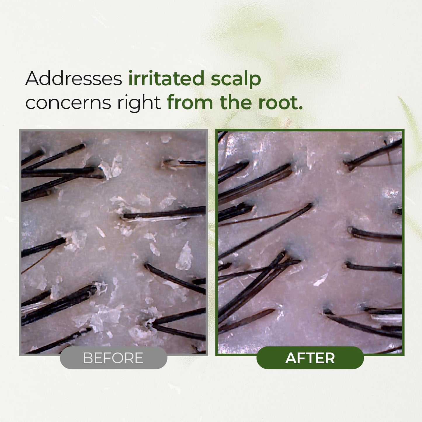 STEAMBASE Tea Tree Scalp Water Scaler | Exfoliator for Itchy Dry Flaky Scalp, Buildup Remover, Treatment for Excess Sebum Oily Greasy Hair | Korean Hair Care Products, Refill 16.9 fl oz