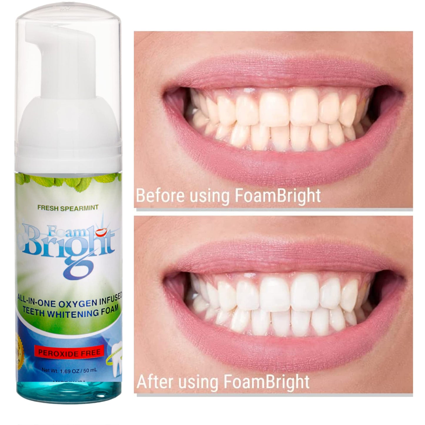 Retainer Cleaner & Aligner Cleaner FoamBright + Travel Retainer Case Kit | Great for Invisalign Aligners, Candid, Byte, Denture Cleaner | Whitens Teeth, Peroxide Free Oral Care | No Tablets Needed