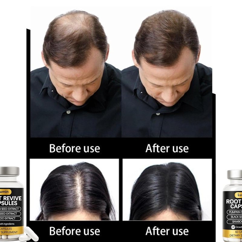 Lumin Root Revive Capsules – Hair Support Supplement for Thinning Hair, Healthy Scalp & Thickness – With Biotin, Black Seed, Bamboo, Saw Palmetto & 17 Nutrient-Rich Ingredients (1)