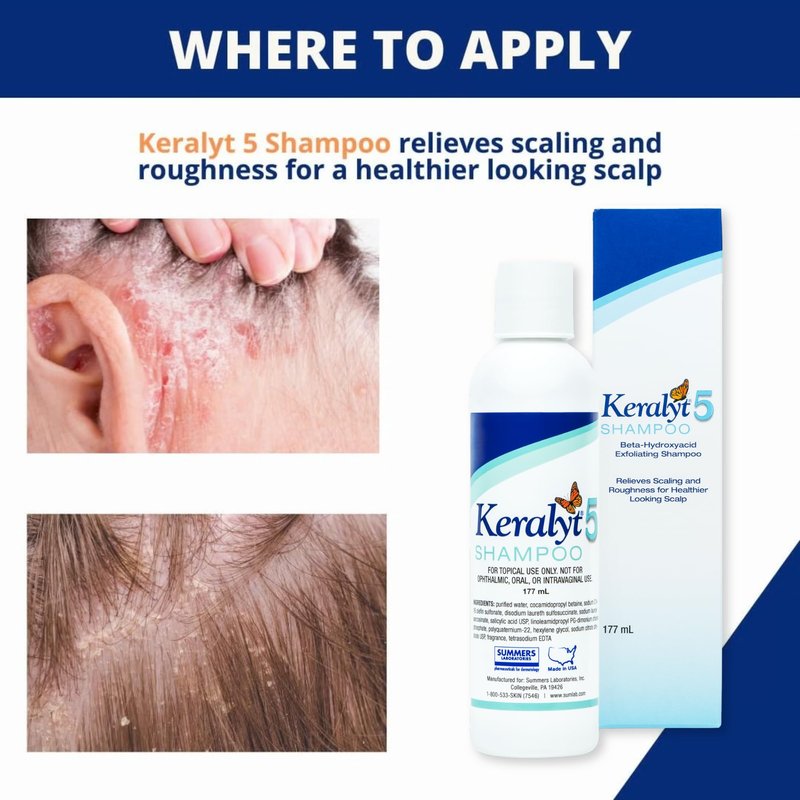 Keralyt 5 Anti-Dandruff Shampoo - Max Strength 5% Salicylic Acid Scalp Build-Up Clearing - Promotes Relief from Dandruff, Psoriasis, Seborrheic Dermatitis, Dryness, and Itchiness, 177 milliliters