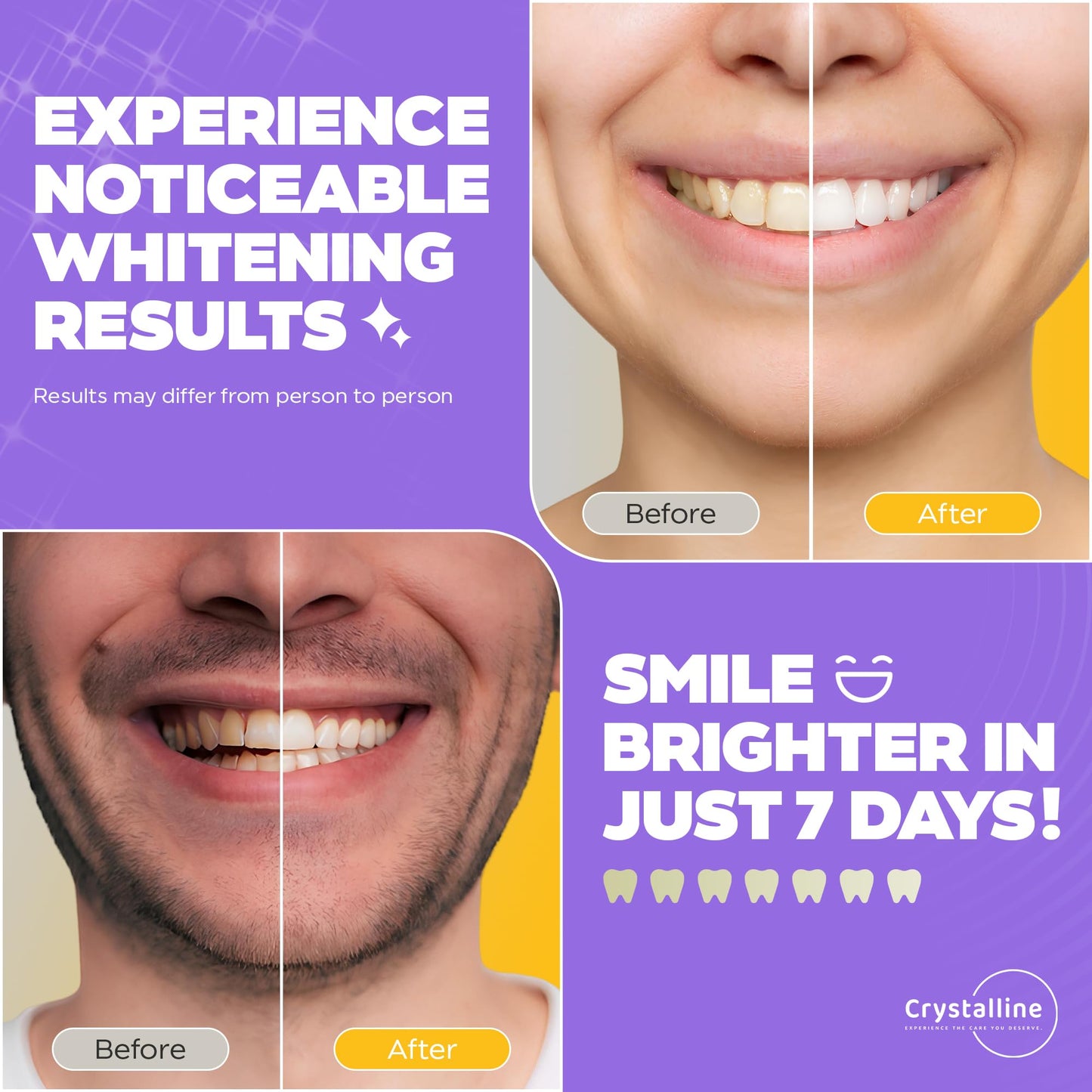 Crystalline Teeth Whitening Strips – 42 Strips (21 Treatments, 3 Weeks Supply) – Enamel Safe, All-Natural Ingredients – Professional at-Home Whitening for a Brighter Smile