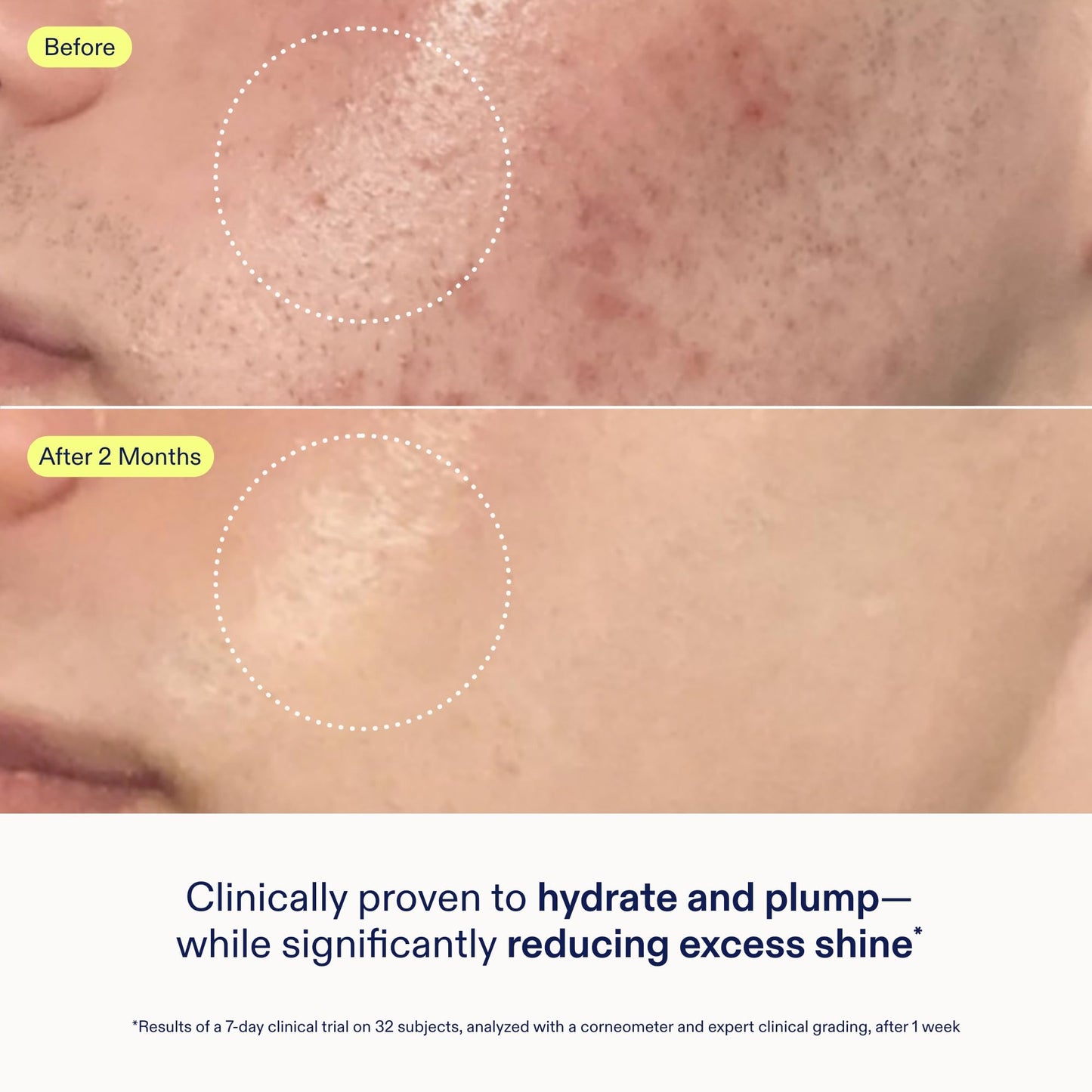 Skinfix Skin Barrier Restoring Gel Cream - 1.7 oz - Non-Greasy Moisturizer for Normal to Combination Skin - Hydrates, Plumps & Smooths - Non-Comedogenic, Fragrance Free, Vegan, Cruelty Free