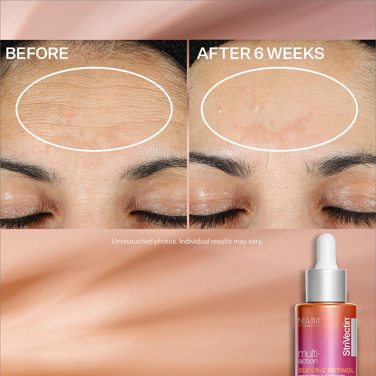 StriVectin Super-C Retinol Brighten & Correct Vitamin C Serum, Antioxidant Face Serum for Uneven Tone, Fine Lines, and Firmness, 1 oz Drops for Face