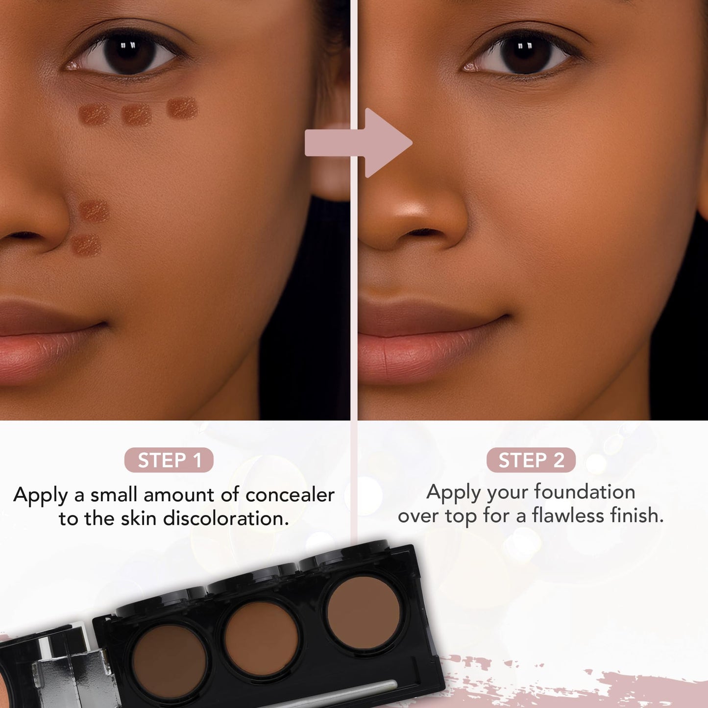 Full Coverage Concealer Palette, Waterproof Concealer Cream, 3 Colors + Brush, by Dermaflage