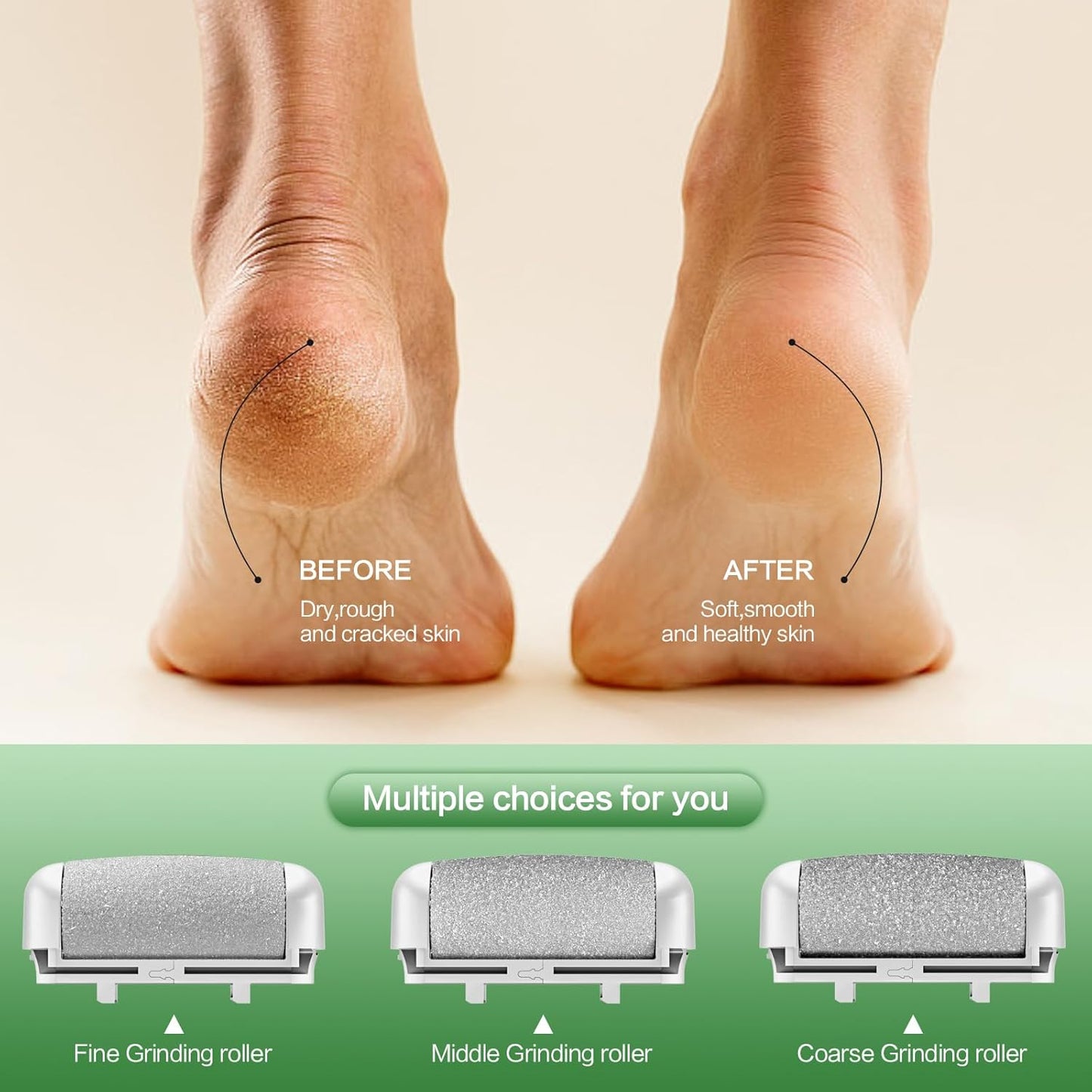 Electric Foot Callus Remover - Rechargeable Waterproof Foot File with LED Light & 3 Rollers | USB-C Charging, White