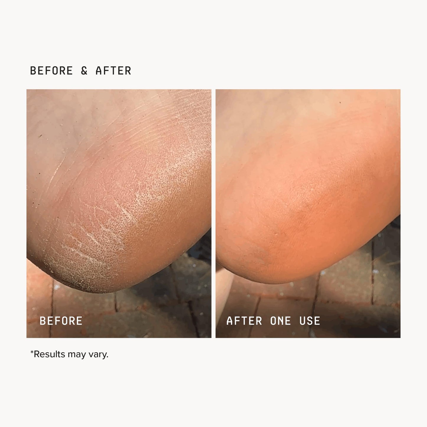 DRMTLGY Concentrated Foot Cream | Dry Cracked Feet & Heel Repair