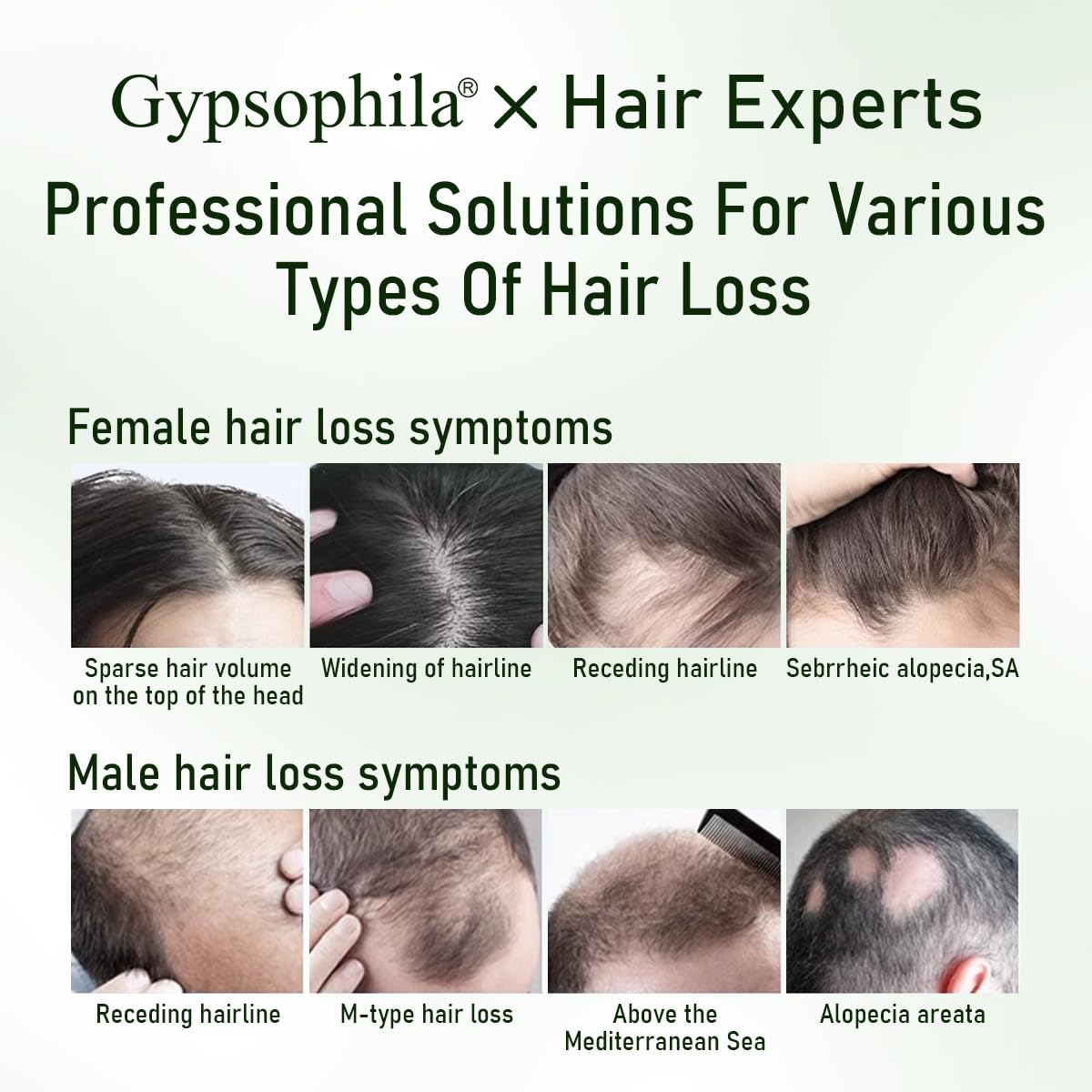 Gypsophila Batana Oil Hair Growth Bundle-Batana Oil Shampoo and 100% Pure Natural Rosemary -Natural Hair Treatment for Women & Men –Hair loss & Thicker, Healthier Hair