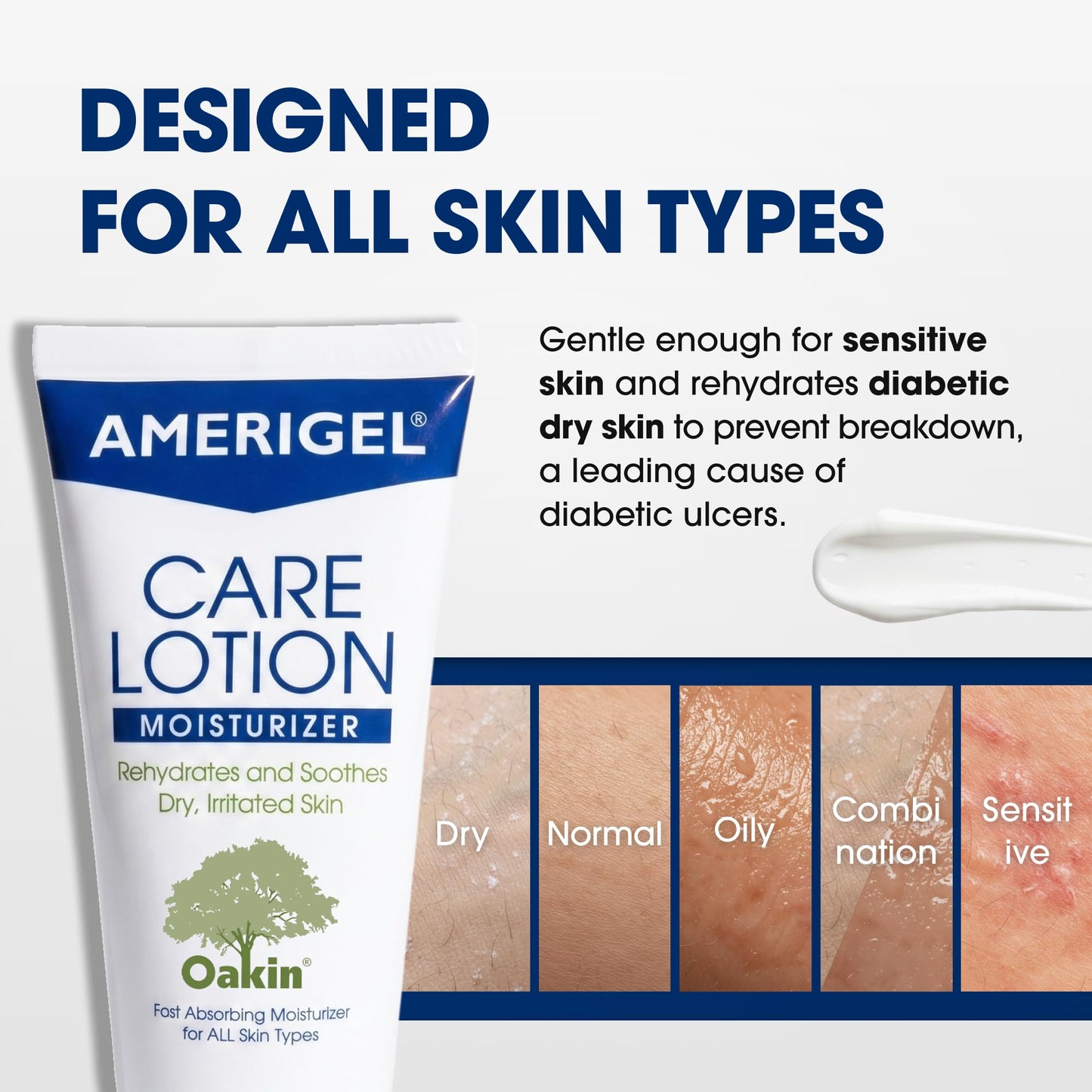 AMERIGEL Care Lotion – Hypoallergenic Moisturizer - Diabetic Skin Care - Rehydrates and Soothes Dry, Irritated Skin - 6 oz.