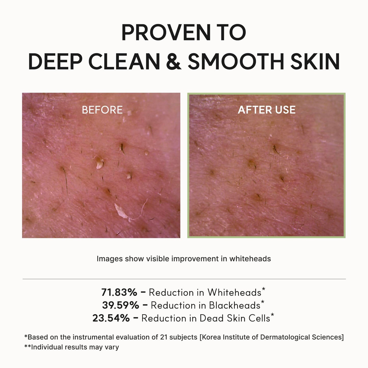 Arencia Korean Rice Mochi Face Cleanser - Face Wash, Gentle Scrub All in One for Deep Cleansing, Moisturizing, Pore Minimizing, Acne-Prone Skin, Removing Blackhead with Rice Water & Green Tea