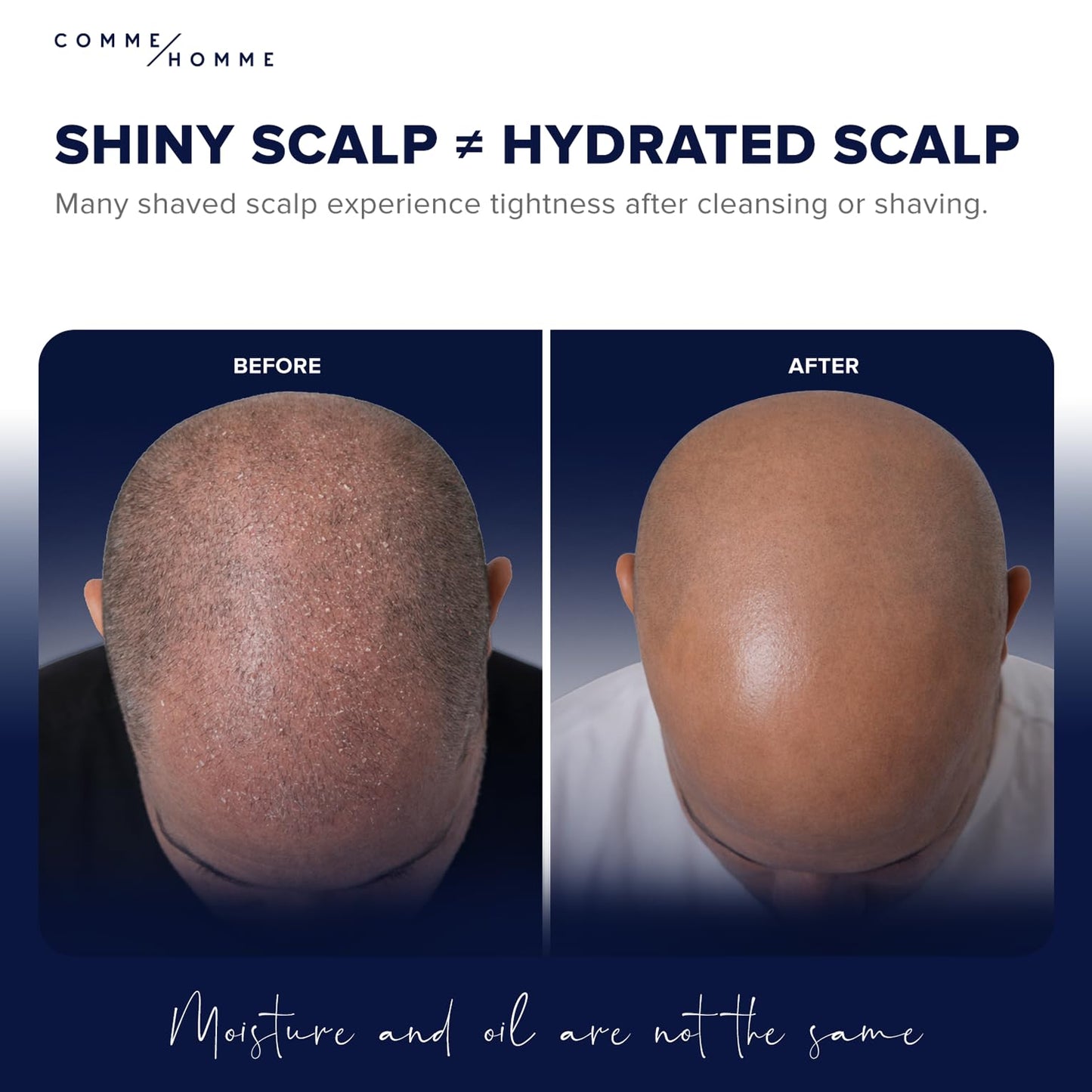 Comme Homme Soothing Scalp Moisturizer for Bald Men | Hydrates, Softens & Slows Regrowth with Aloe, Mango Butter & Capislow | Anti-Itch, Non-Greasy Daily Scalp Care for Bald Heads | 3.4 fl oz/100 ml