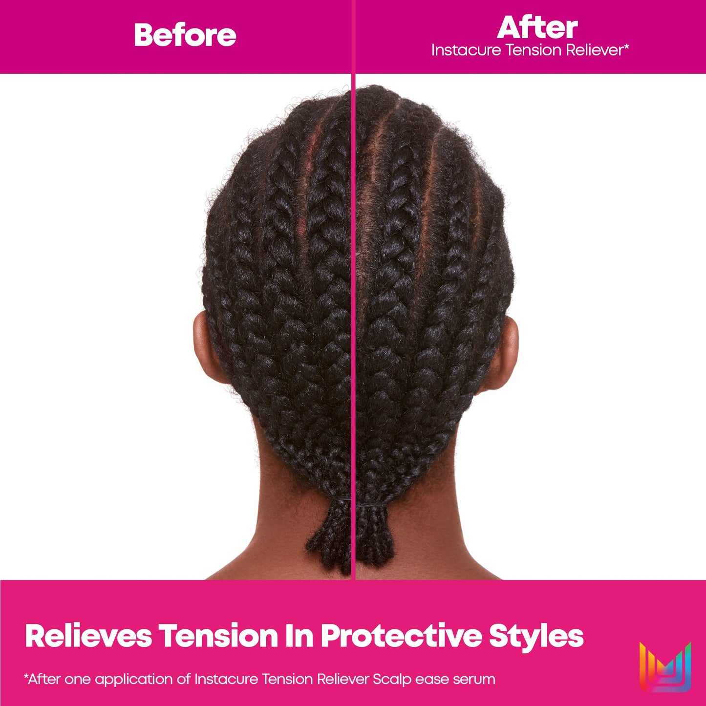 Matrix Instacure Tension Reliever Leave-In Scalp Serum - Moisturizes Dry and Irritated Scalp, Cools Tension in Braids, Protective & Tight Hairstyles, 6.8 Fl Oz