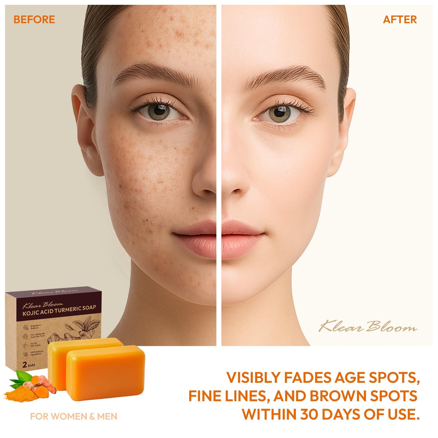 KlearBloom Kojic Acid Soap, Turmeric Soap Bar for Dark Spots Brightening & Moisturizing with Collagen, Vitamin E, Retinol, Hyaluronic Acid, Shea Butter, Paraben & Sulfate-Free 105g x4 Bars With Holder