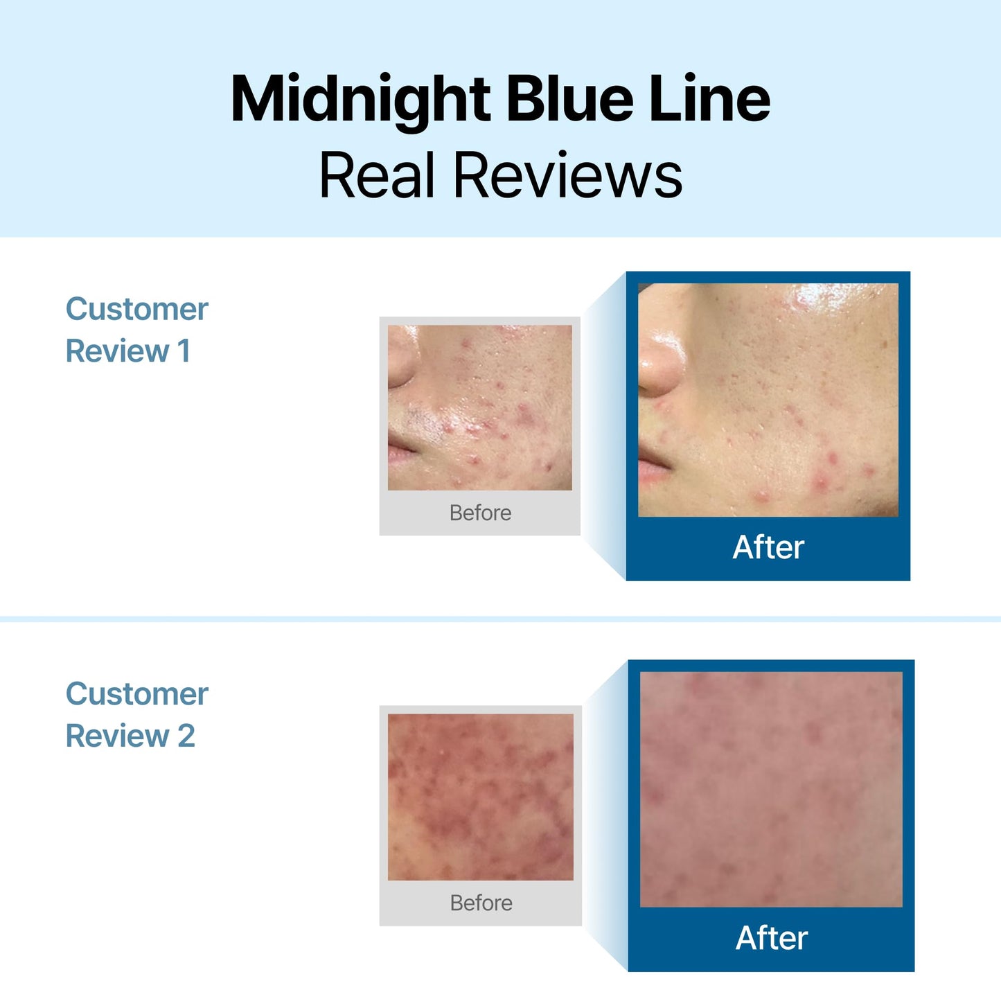 DearKlairs Blue Calming Cream | Face Moisturizer for Redness Relief, 2.11oz