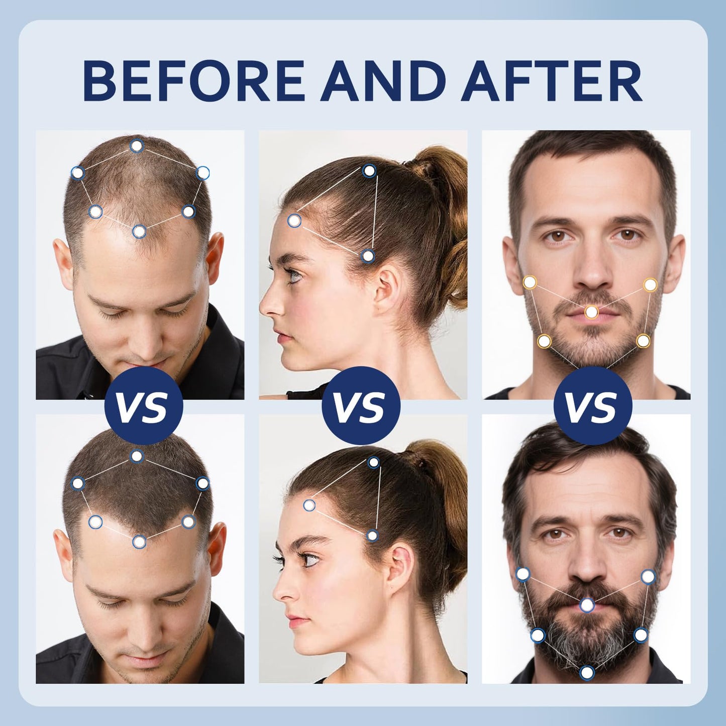 5% Minoxidil Hair Growth Serum for Men & Women with Biotin: Minoxidil for Men and Women, 5 Percent, Hair Regrowth Treatment, Extra Strength